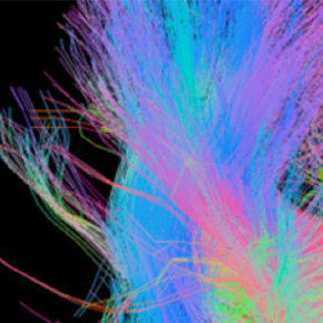 Isabelle Raynauld| Brain, Music and Memory Isabelle Raynauld| Brain, Music and Memory